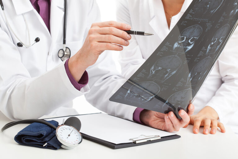 closeup of a doctor examining a patient's x-ray chart